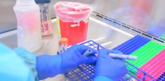 Reportan 227 casos de COVID-19 correspondientes a la jornada del 15 de agosto